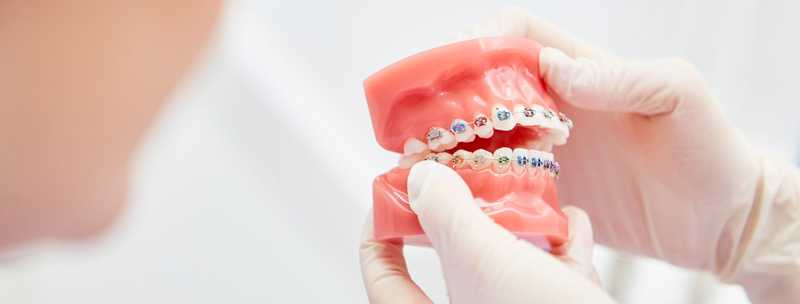 Kieferorthopädie in Spandau feste Zahnspange